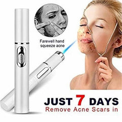 Blue Light Therapy Acne Laser Pen Soft Scar Wrinkle Removal Treatment Device Skin Care Beauty Equipment.