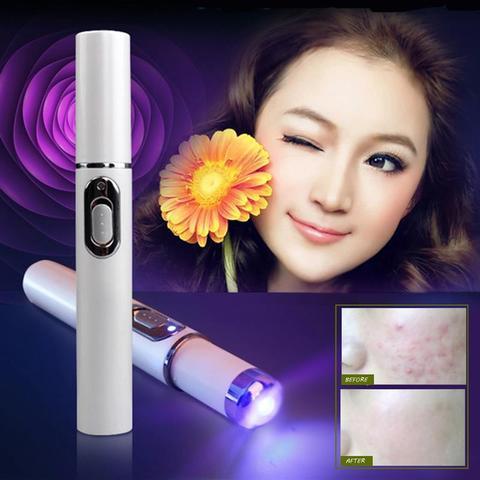 Blue Light Therapy Acne Laser Pen Soft Scar Wrinkle Removal Treatment Device Skin Care Beauty Equipment.