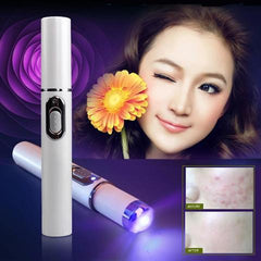 Blue Light Therapy Acne Laser Pen Soft Scar Wrinkle Removal Treatment Device Skin Care Beauty Equipment.