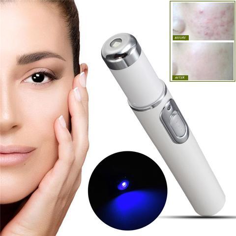 Blue Light Therapy Acne Laser Pen Soft Scar Wrinkle Removal Treatment Device Skin Care Beauty Equipment.